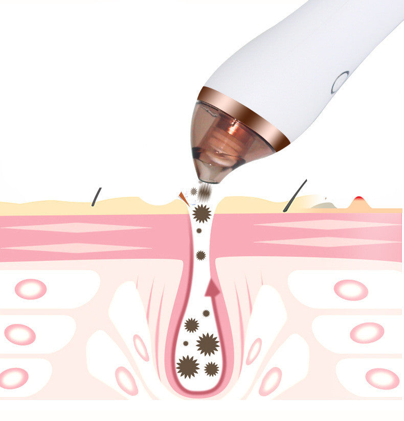 Apux Glow 1.0 [Blackhead Remover Machine]